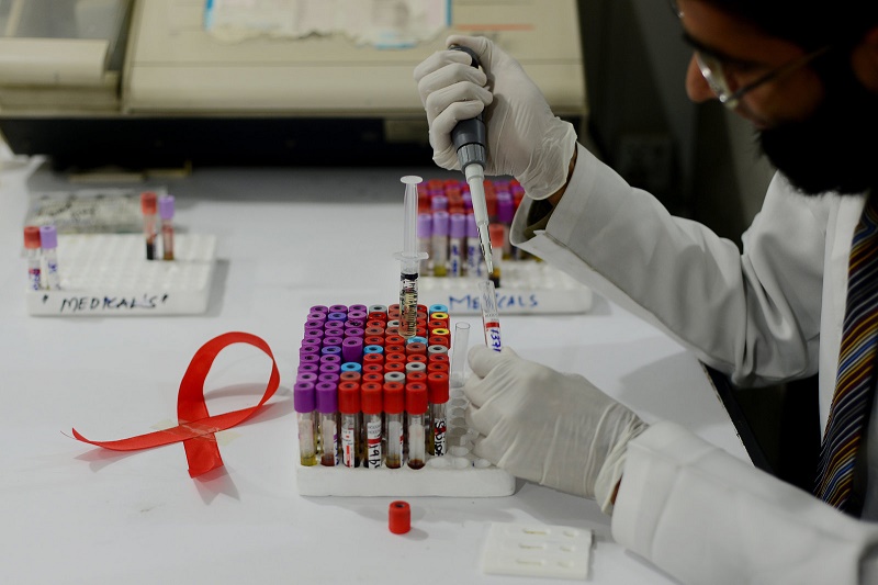 دانشمندان به درمان قطعی بیماری HIV‌ نزدیک می‌شوند