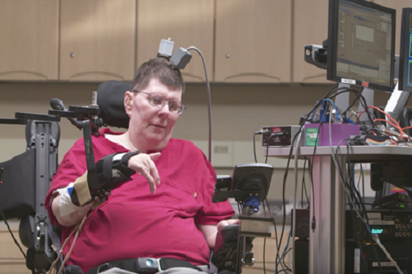 ایمپلنت‌های عصبی ARM برای معلولان