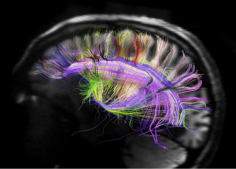 پژوهشگران برای اولین بار مغز انسان را به اینترنت متصل کردند