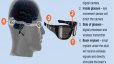 ترمیم بینایی مصنوعی با دوربین چشمی و تراشه مغزی