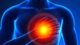 هوش مصنوعی حملات قلبی را بهتر از پزشکان پیش‌بینی می‌کند