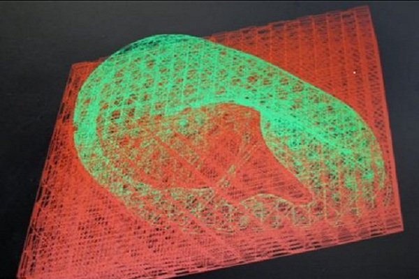 امکان ساخت بافت استخوانی آسیب‌دیده در کشور