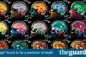 سن مغز می‌تواند زمان مرگ انسان را بگوید